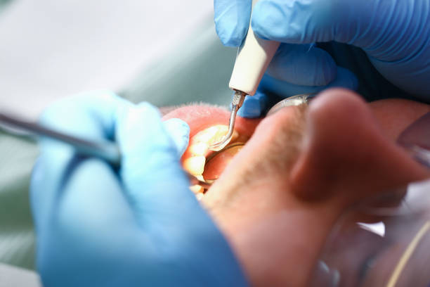 Best Emergency Dental Surgery in Fort Gibson, OK