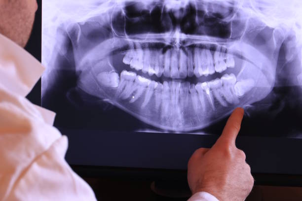 Best Emergency Tooth Extraction in Fort Gibson, OK