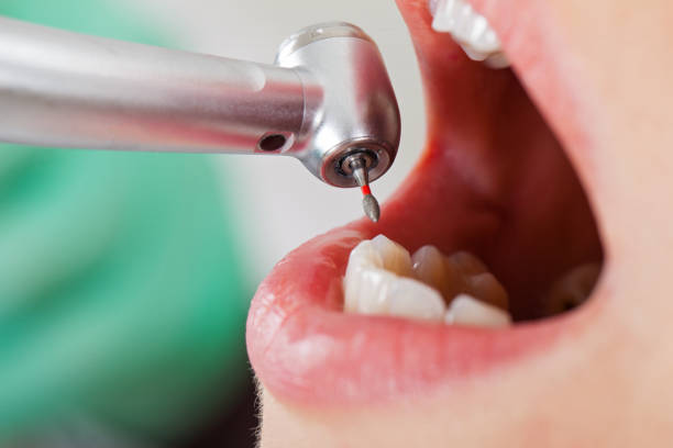 Best Walk-In Emergency Dentist in Fort Gibson, OK